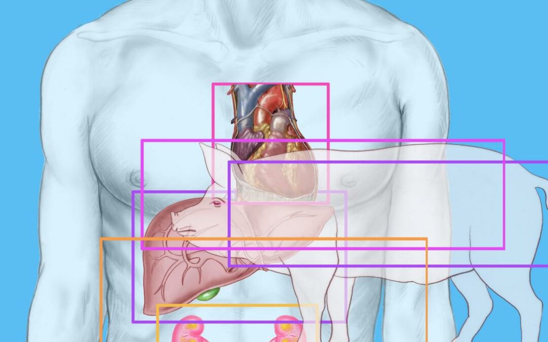 A Man Who Had Been Living With A Transplanted Pig’s Heart For 40 Days Died Suddenly